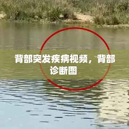 背部突发疾病视频,背部诊断图